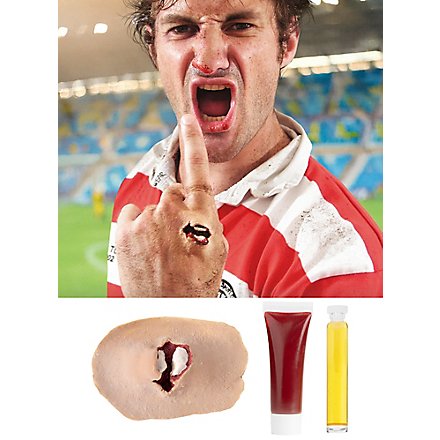 Offener Bruch Latexapplikation