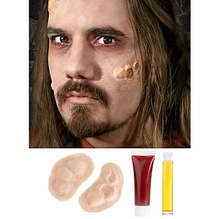 Pestbeulen Latex Applicatie