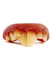 Denti di topo