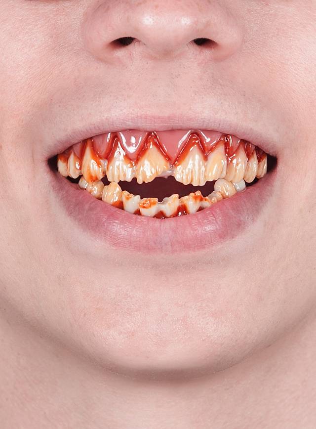 Dental FX Psycho Zähne.