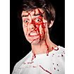 Bloedspray