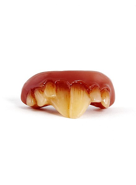 Dents de rat