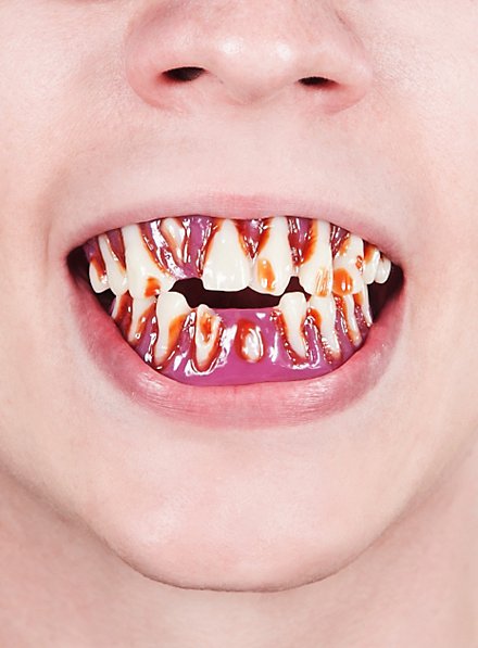 Dentier pour se déguiser en mort vivant / zombie - Fausses dents pourries