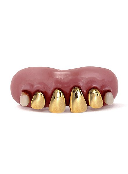 Golden Gums Zähne