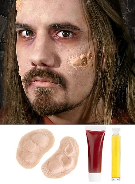 Pestbeulen Latexapplikation