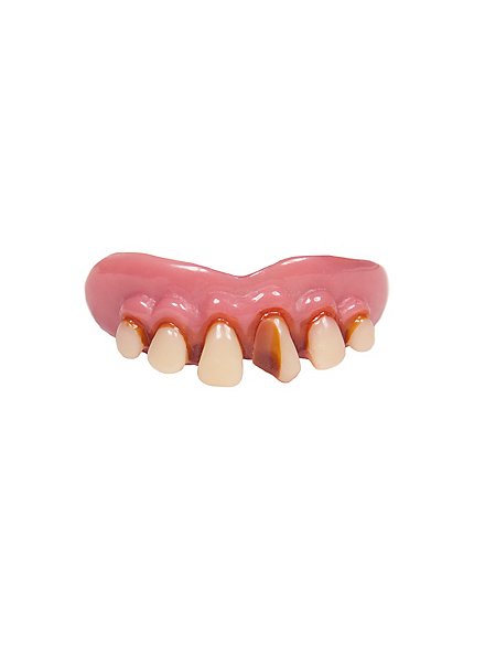 Urmensch Zähne