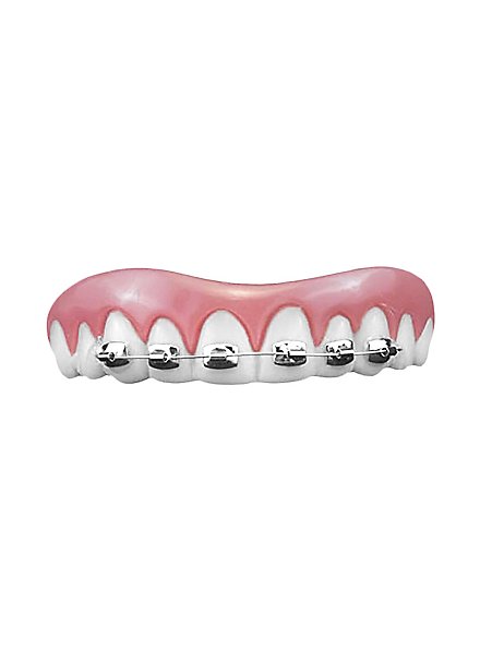 Zahnspangen Zahnleiste