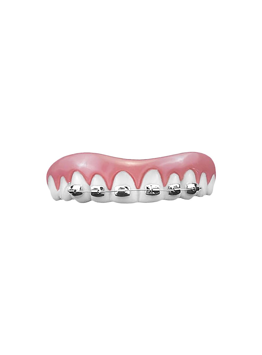 Braces dental bar