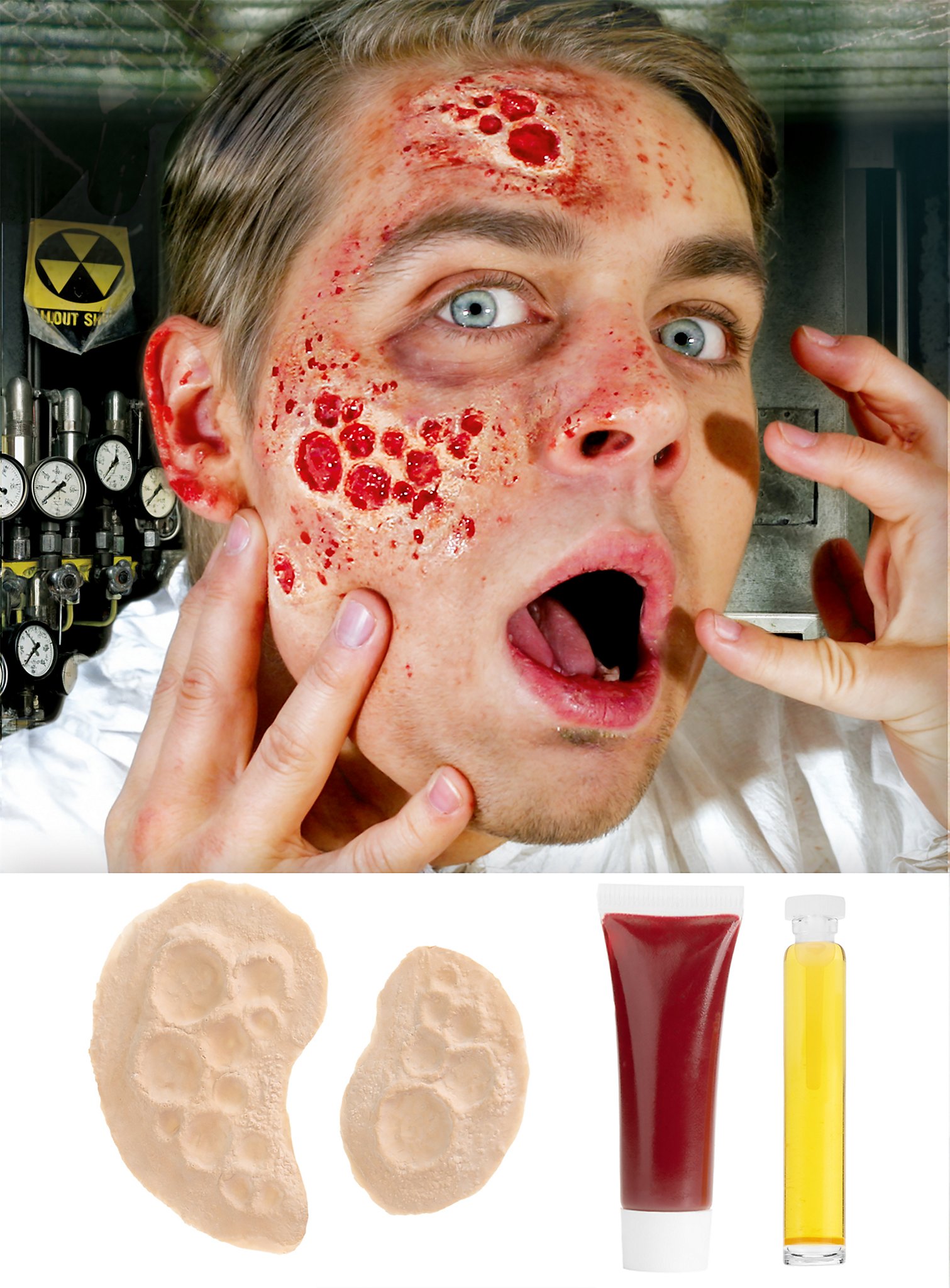 Strahlenbrand Wunden aus Latex