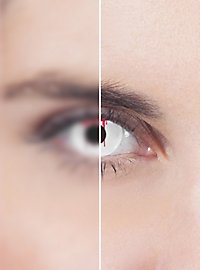 Bleeding Eye white Prescription Conant Lens