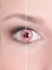 Bloodshot contact lens with dioptric