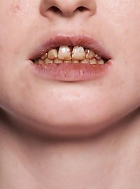 Esmalte Dental Nicotina 10ml Frasco Con Pincel