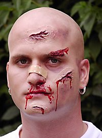 Narbenset, 3 Wunden, Blut