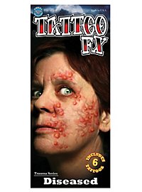 Pestbeulen Plak-Tattoo