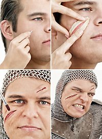 Snitlæsioner Latexapplikation