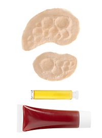 Strahlenbrand Latexapplikation