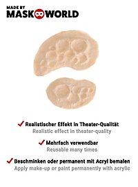 Strahlenbrand Latexapplikation