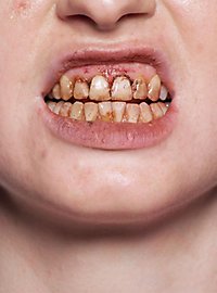 Tooth Enamel nicotine 