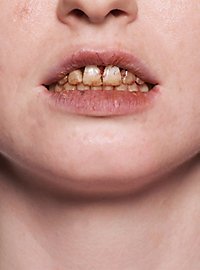 Tooth Enamel nicotine 